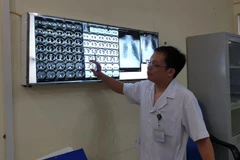 Bác sỹ đọc phim chụp cho bệnh nhân. (Ảnh: PV/Vietnam+)