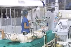 Hội chẩn liên viện điều trị 3 chiến sỹ trong vụ máy bay rơi