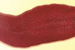 Hình ảnh sán lá gan.