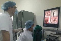 Các bác sỹ đang thực hiện để lấy con vắt ra khỏi cổ của bệnh nhân. (Ảnh: Bác sỹ cung cấp)