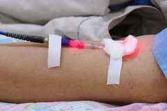 [Mega Story]: 'Cơn lốc' bệnh viện mở rộng bằng y học cổ truyền 