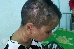 Xử lý nghiêm vụ chủ nhà tra tấn, đánh đập dã man người làm công