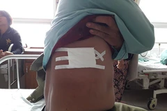 Thăm hỏi hai "hiệp sỹ" bị thương khi truy bắt tội phạm ở Đồng Nai