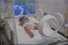 Bệnh nhi N.H.H đang được tích cực điều trị tại Bệnh viện Nhi đồng Đồng Nai. (Ảnh: Lê Xuân/TTXVN)