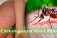 (Nguồn: Homeopathyforfree)