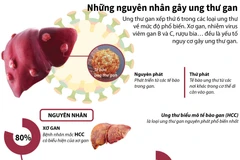 [Infographics] Tìm hiểu những nguyên nhân gây ung thư gan