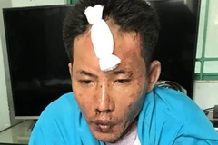 Bị đổ xăng đốt do mâu thuẫn tình cảm, hai con tử vong, mẹ nguy kịch 