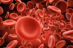 Ảnh minh họa. (Nguồn: medicalnewstoday.com)