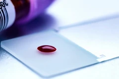 Thiết bị mới này chỉ cần một giọt máu. (Nguồn: futurity.org)