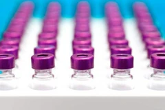 Ảnh minh họa. (Nguồn: her.ie)