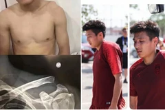 Wu Lei bị chấn thương. (Nguồn: foxsportsasia.com)