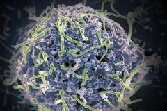 Virus Ebola. (Nguồn: wvxu.org)