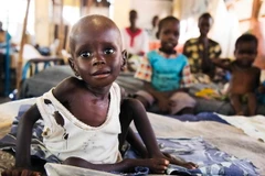 Trẻ em Sudan bị suy dinh dưỡng điều trị tại một bệnh viện ở Aweil. (Nguồn: AFP/TTXVN) 