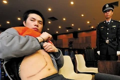 Một thanh niên Trung Quốc khoe vết mổ, dấu tích của lần bán nội tạng. (Nguồn:Internet)