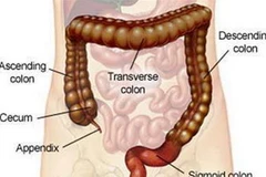 Hình minh họa ung thư ruột. (Nguồn: Internet)