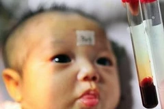 Ảnh chỉ mang tính minh họa. (Nguồn: Internet)