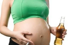 Ảnh minh họa. (Nguồn: Internet)