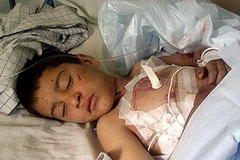 Một em nhỏ Afghanistan bị thương bởi bom mìn. (Nguồn: Reuters)