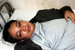 Phóng viên Trần Thế Dũng tại thời điểm điều trị tại Bệnh viện Việt Đức (Hà Nội) chiều 8/1. (Ảnh: Báo Người Lao động)