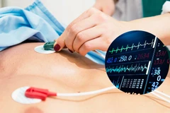 Phương pháp mới giúp chẩn đoán nhanh chứng nhồi máu cơ tim