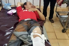 Ông Phan Ngọc Khoa, Hạt phó Hạt Kiểm lâm Krông Nô bị xe càng cán qua chân khi tham gia bắt giữ gỗ lậu. (Ảnh: Hưng Thịnh/TTXVN)