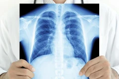 (Nguồn: qt.com.au)