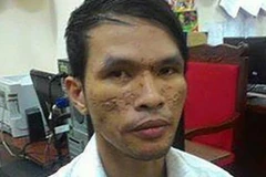 Mở rộng điều tra đối tượng ngược đãi cháu bé người Campuchia