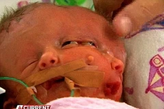 Nhiều kỷ vật vô giá của cặp song sinh đặc biệt bị phá hoại