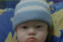 Phẫn nộ với cặp vợ chồng bỏ rơi "đứa con thuê đẻ" mắc bệnh Down