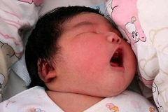 Bác sỹ ngỡ ngàng khi bé trai mới sinh nặng bằng trẻ 3 tháng tuổi