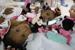 Hai bé gái Cameroon Bissie và Eyenga Merveille. (Nguồn: lci.fr)