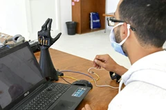 Công ty Cure Bionics phát triển bàn tay nhân tạo bằng công nghệ in 3D (Nguồn:Bangkokpost)