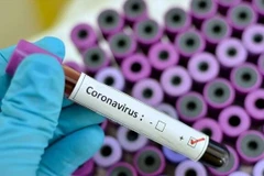 Ảnh minh họa. (Nguồn: The Iran Project) 