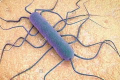 Vi khuẩn Listeria. (Nguồn: alamy) 