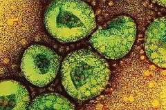 Ảnh minh họa. (Nguồn: newsfirst.lk)