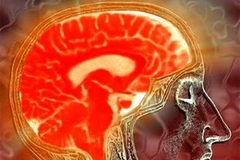 Ảnh minh họa (Nguồn: Internet)