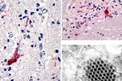 Virus Enterovirus 71 (Nguồn: Internet)