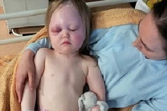 Cô bé bên mẹ sau khi được phẫu thuật. (Nguồn: Caters News Agency) 