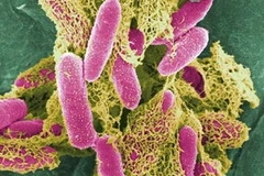 Khuẩn đường ruột Escherichia coli (Nguồn: Internet)