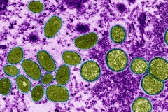 Virus đậu mùa khỉ hiển thị dưới kính hiển vi điện tử màu. (Nguồn: science.org)