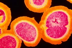 Các nhà nghiên cứu Australia hy vọng khám phá mới sẽ giúp ích trong cuộc chiến chống lại siêu vi khuẩn. (Nguồn: theguardian.com)