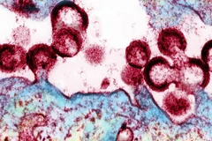 (Nguồn: statnews.com)