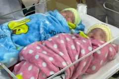 Lần đầu tiên tại Việt Nam, các y bác sỹ đã nuôi sống thành công cặp song sinh nặng 500g, chào đời ở tuần thai thứ 25. (Nguồn: suckhoedoisong.vn)