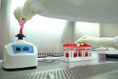 Phân tách mẫu xét nghiệm COVID-19. (Ảnh: Minh Quyết/TTXVN)