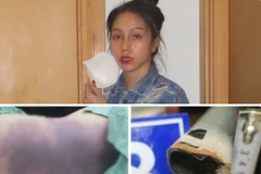 Bị can Nguyễn Võ Quỳnh Trang và các dấu vết bạo hành cháu gái 8 tuổi. (Nguồn: tuoitre.vn)