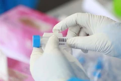 Lấy mẫu xét nghiệm COVID-19. (Ảnh: Hoàng Hùng/TTXVN)