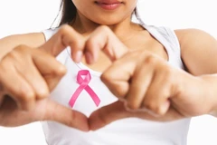 Ảnh minh họa. (Nguồn: Oyibos OnLine)