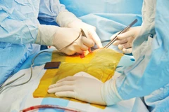 Ảnh minh họa. (Nguồn: Thelocal)