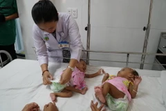 Hai bé gái song sinh Điểu Thị Bảo Ân và Điểu Thị Bảo Hân sau khi phẫu thuật tách dính thành công. (Ảnh: Phương Vy/TTXVN)