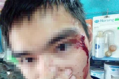 Anh M và vết thương bị hành hung bởi người đàn ông được cho là lái xe của hãng Grab. 